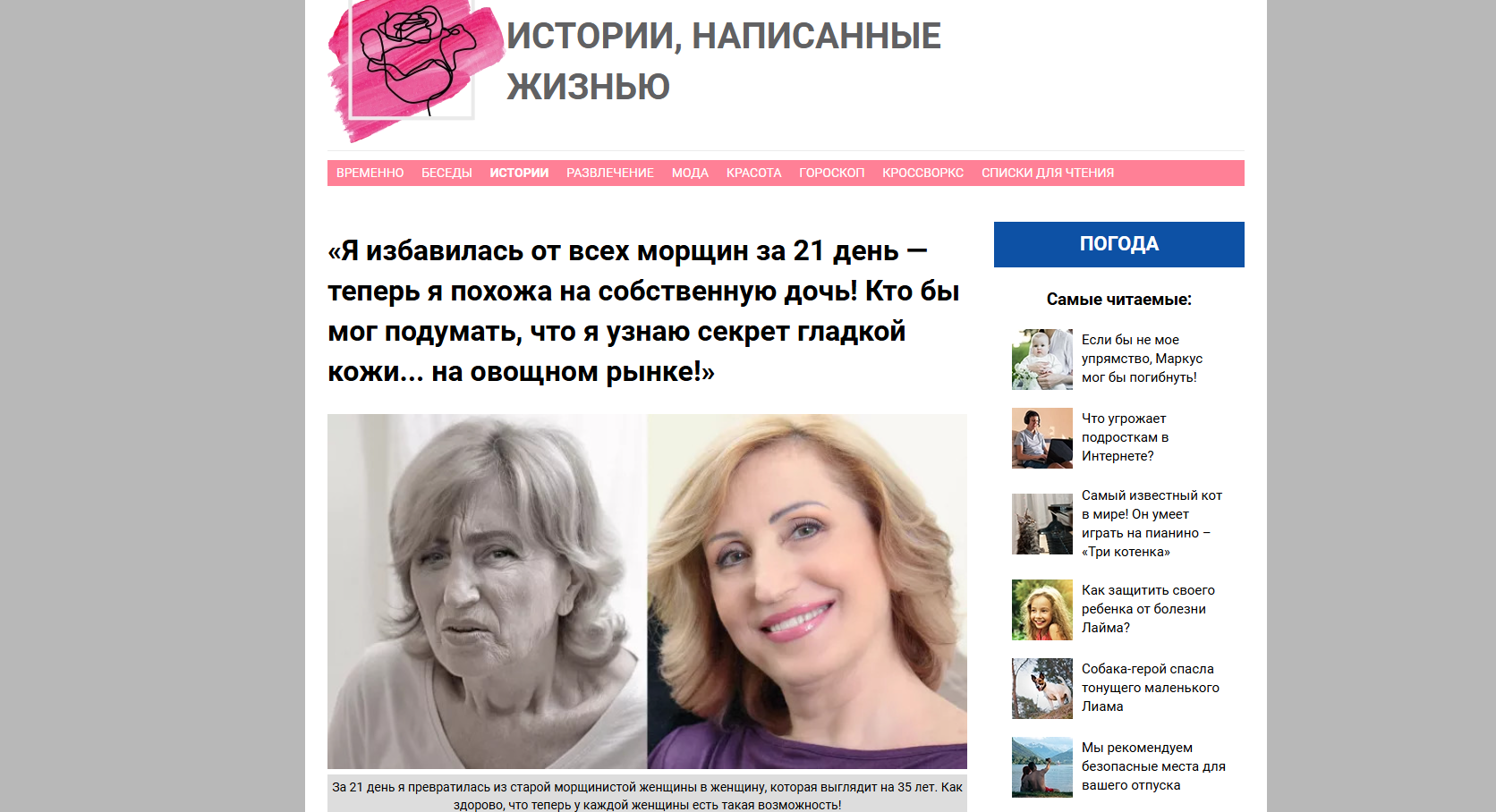 формат «до/после» на омоложение