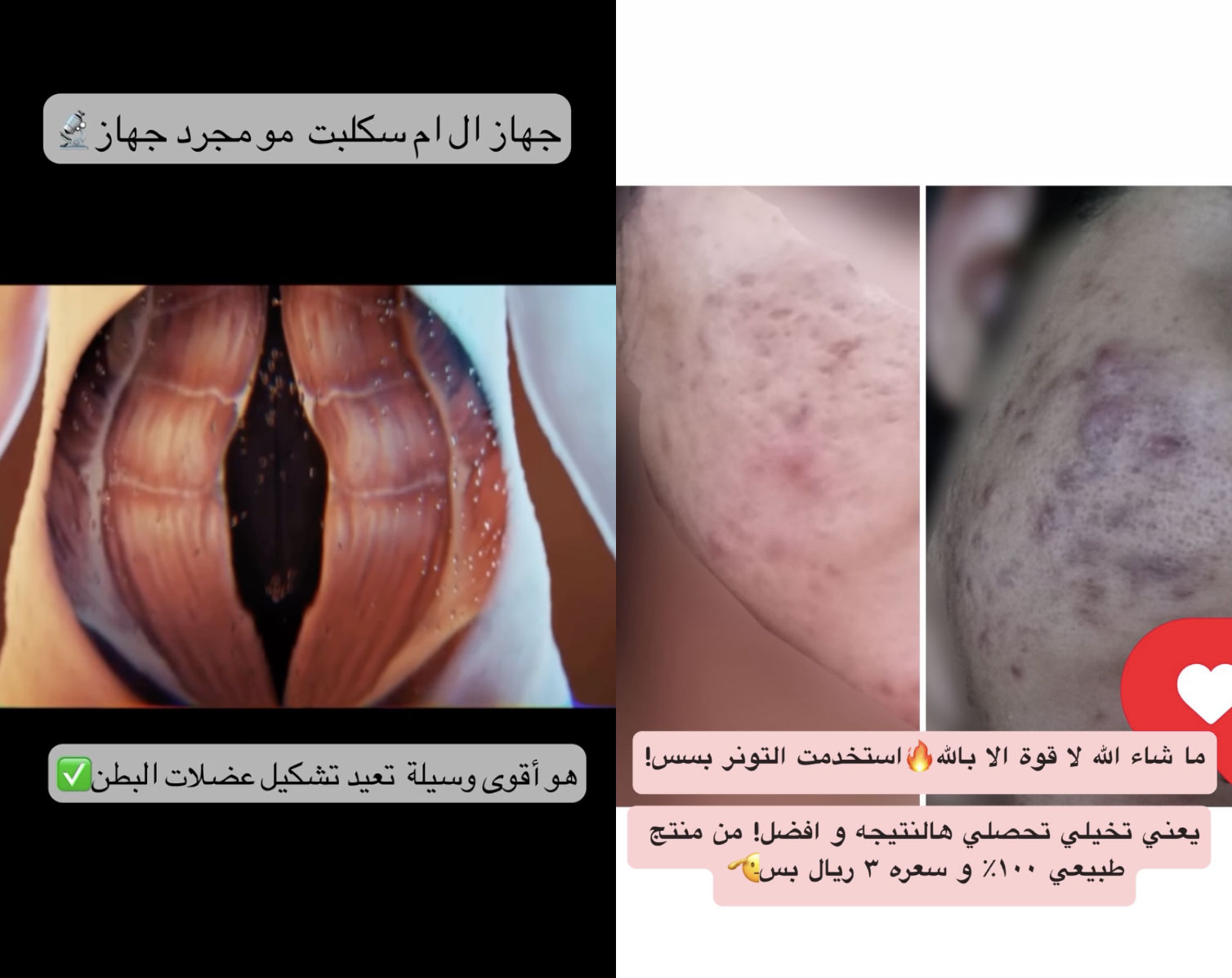 Какие креативы не работают нутра MENA и арабские страны